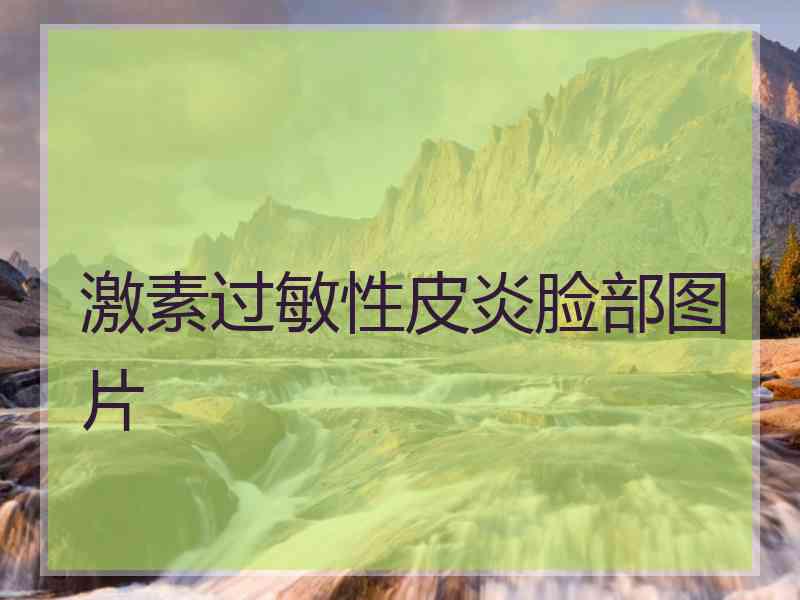 激素过敏性皮炎脸部图片
